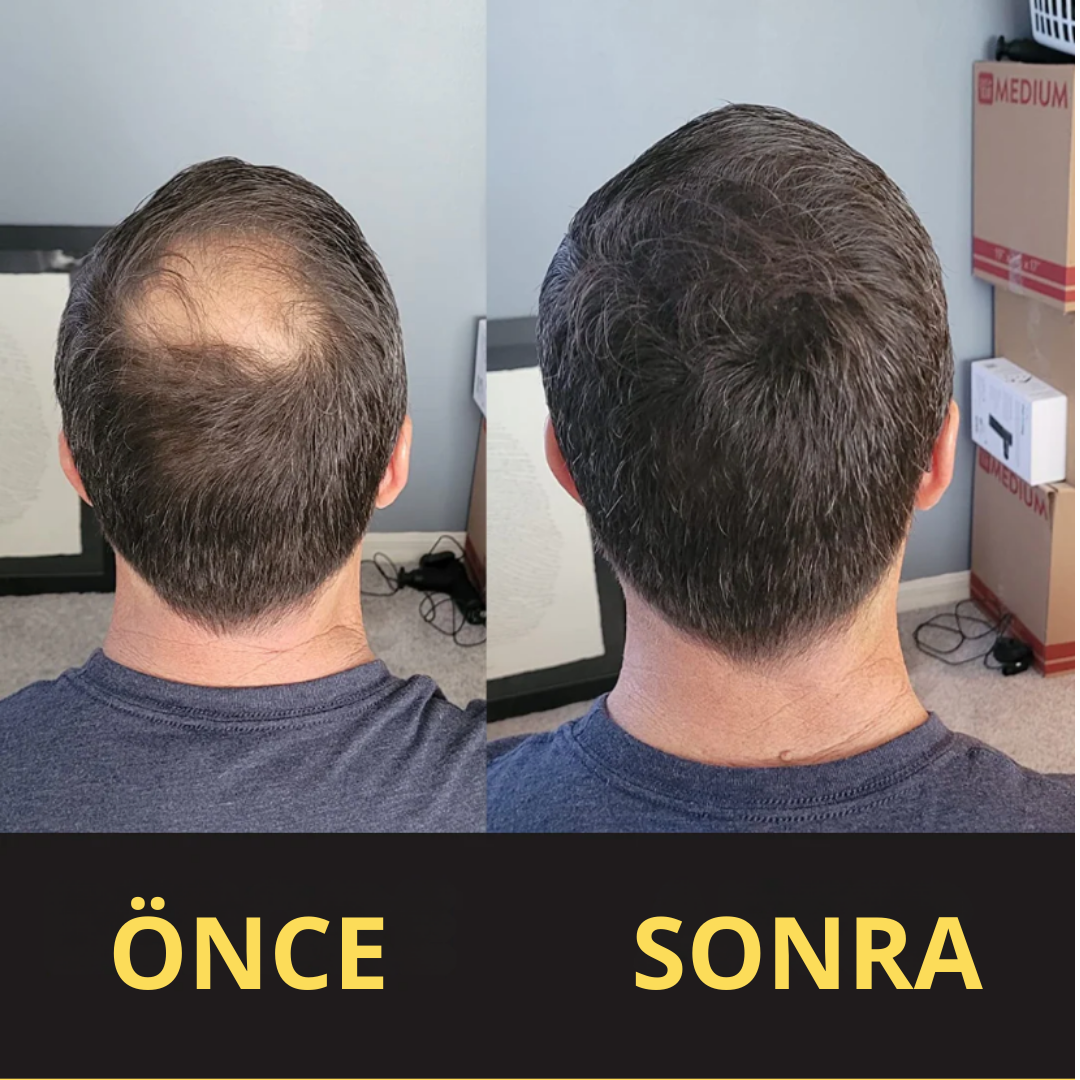 CROWNFILLER SAÇ DOLGU KAPATICI 50 ML – SUYA DAYANIKLI, 3–7 GÜN KALICILIK.