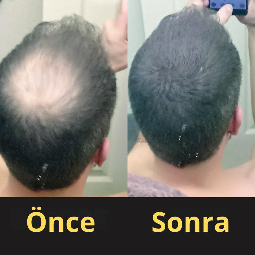 Review by Burak