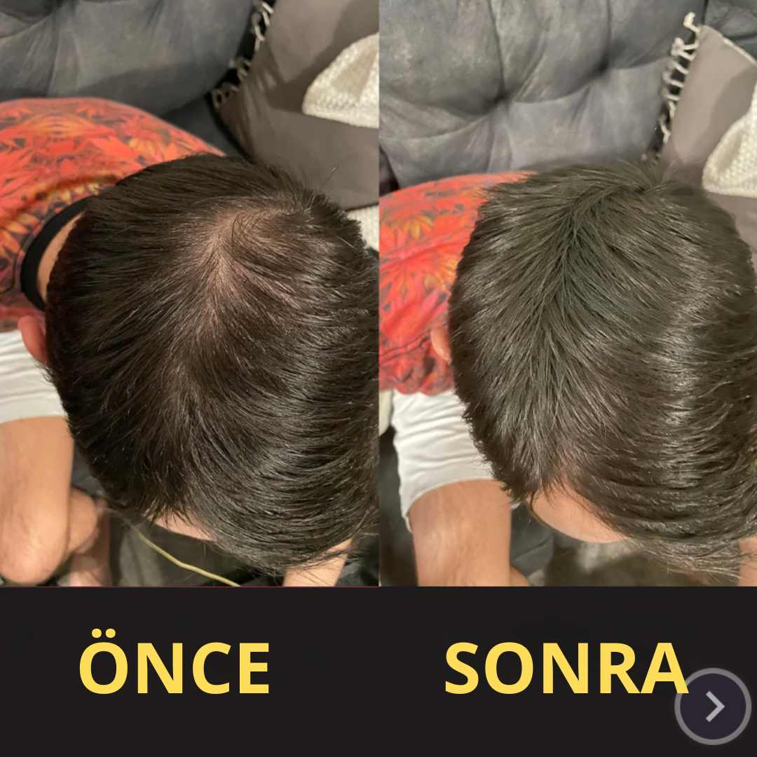 CROWNFILLER SAÇ DOLGU KAPATICI 50 ML – SUYA DAYANIKLI, 3–7 GÜN KALICILIK.