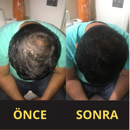 CROWNFILLER SAÇ DOLGU KAPATICI 50 ML – SUYA DAYANIKLI, 3–7 GÜN KALICILIK.