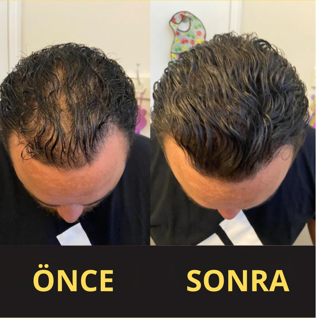 CROWNFILLER SAÇ DOLGU KAPATICI 50 ML – SUYA DAYANIKLI, 3–7 GÜN KALICILIK.