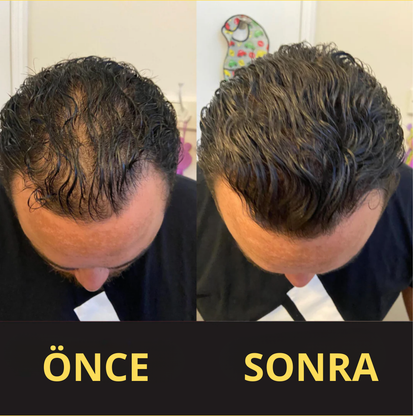 CROWNFILLER SAÇ DOLGU KAPATICI 50 ML – SUYA DAYANIKLI, 3–7 GÜN KALICILIK.