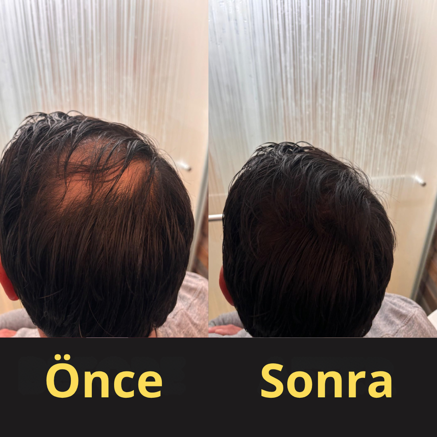 Review by Emre